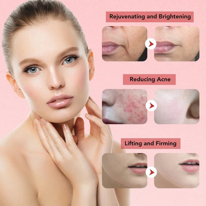 7 in 1 Face Lift Device -  Cleansing Rejuvenation Rose Cosmetics