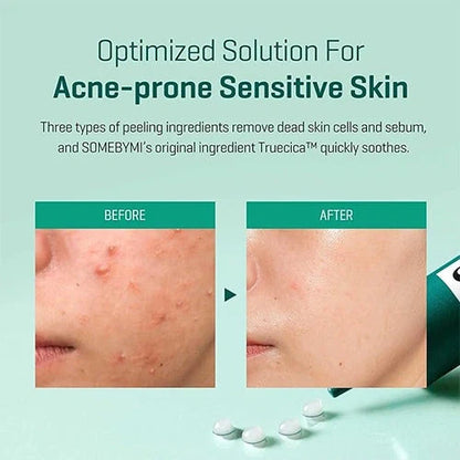 Some By Mi - AHA BHA PHA 14 Days Super Miracle Spot Kill Cream Rose Cosmetics