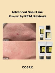 COSRX ALL ABOUT SNAIL KIT FOR DRY SKIN & DARK SPOT Rose Cosmetics